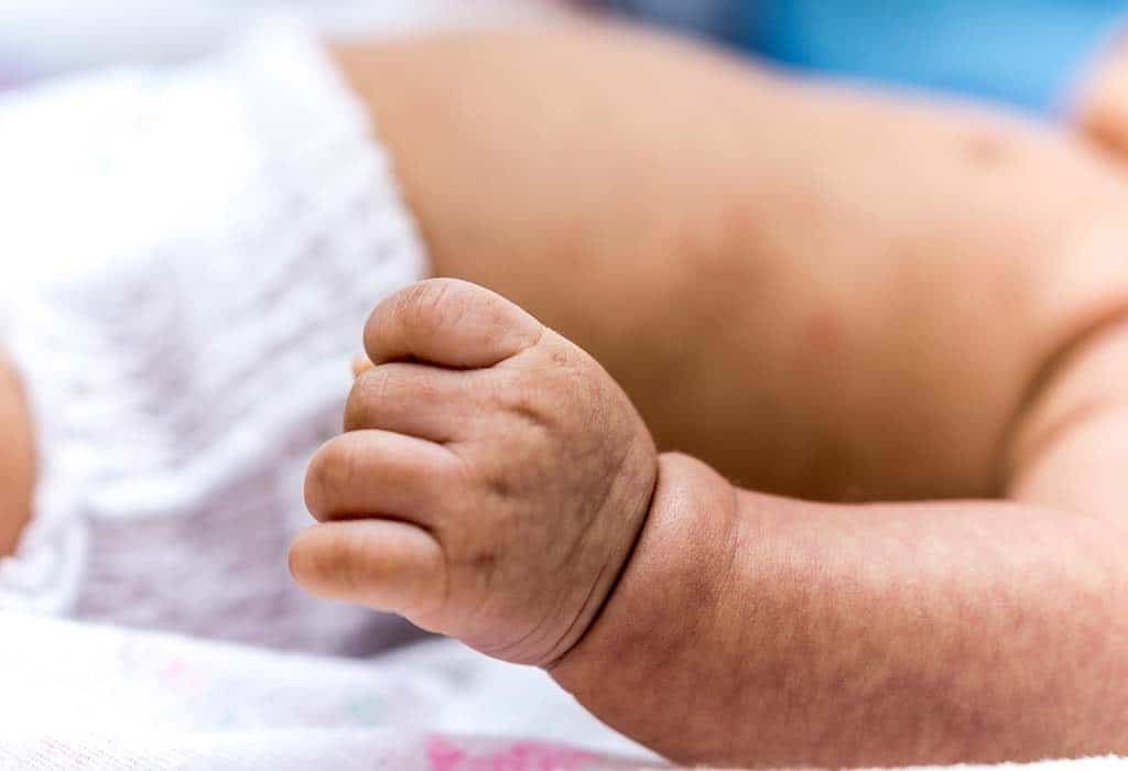 Common Color Issues Found in Newborn Photography