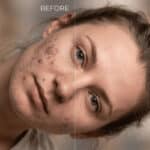 How to Remove Black Spots from Face in Photoshop (Without Losing Texture)