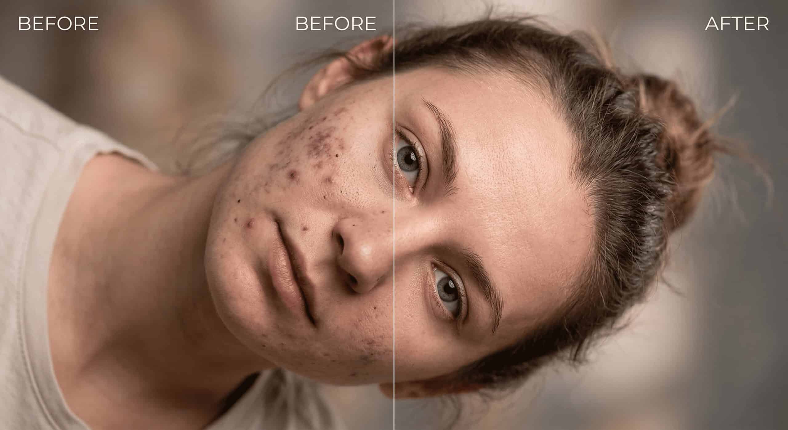 How to Remove Black Spots from Face in Photoshop (Without Losing Texture)